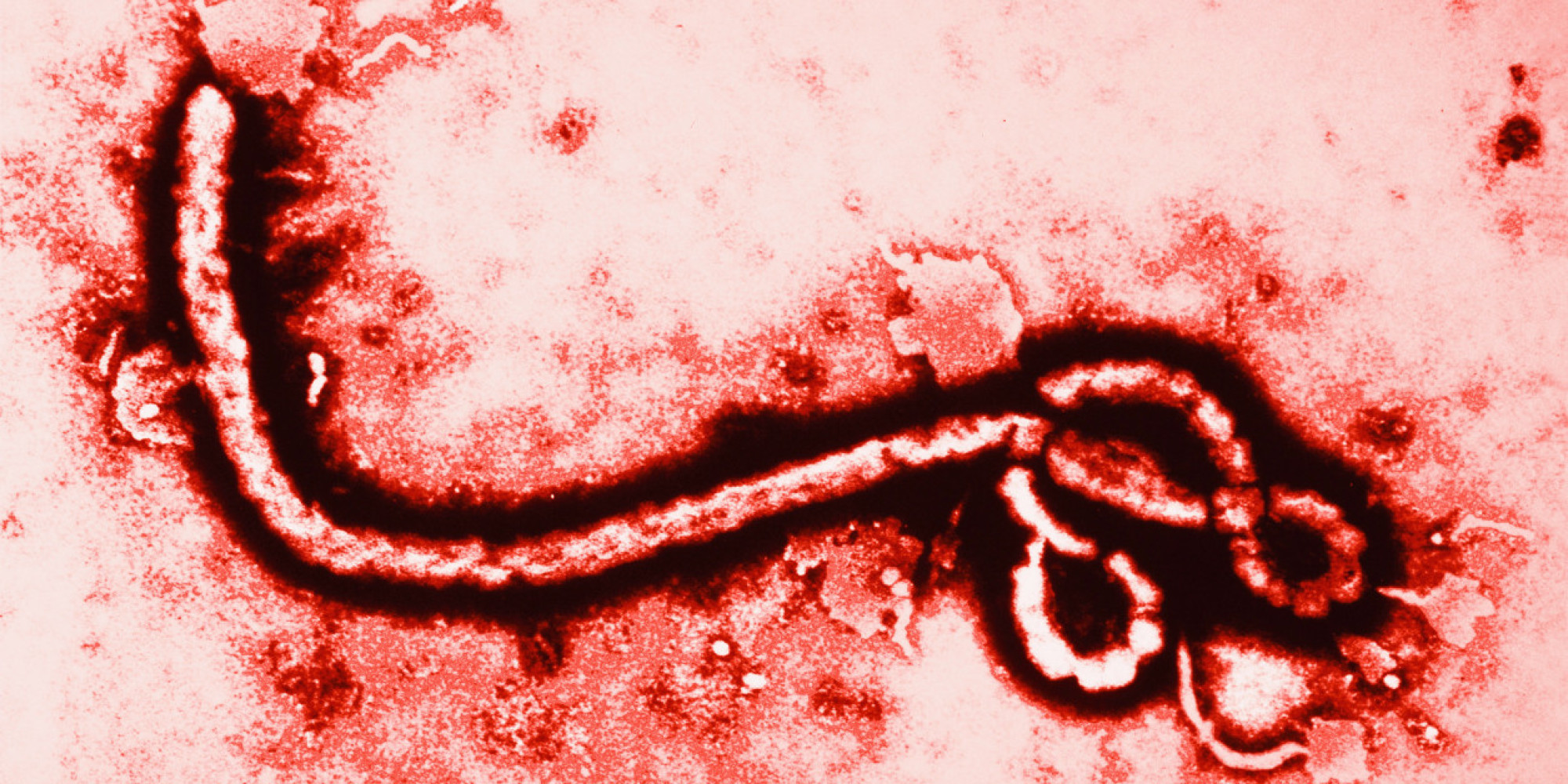 ebola-virüsü-nedir.20141016132139.jpg